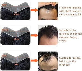 Receding hairline Strip