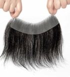 Receding hairline Strip